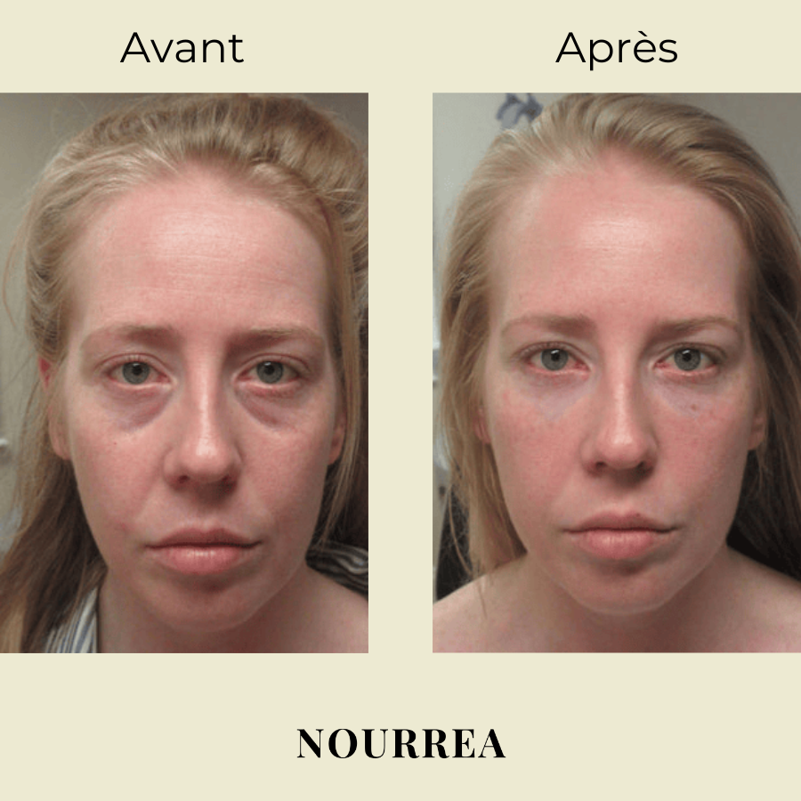 Stick Lèvres NOURREA